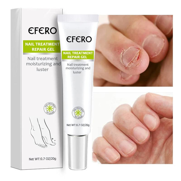 HeilendeNägel™ Nagelbehandlung Repair Gel