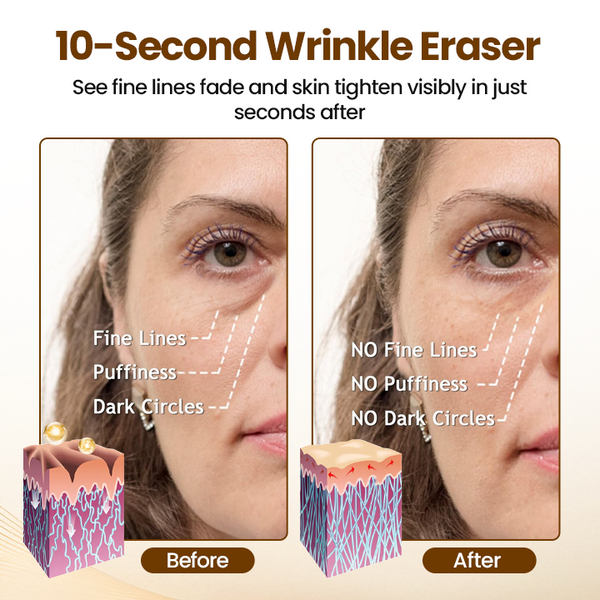 Aureline™ | Renewing 10s Wrinkle Serum – Für Sofort Glatter & Straffer Aussehende Haut