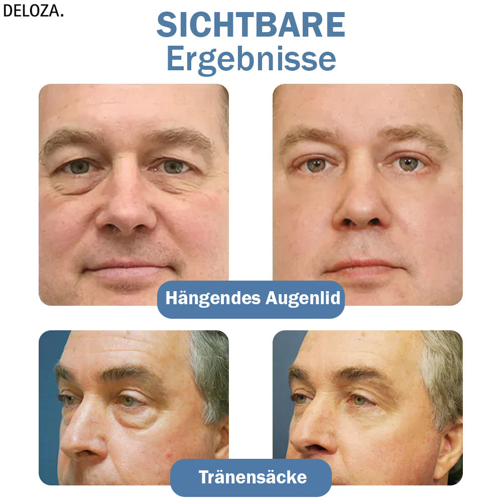 EyeRenew™ | Strahlende & jugendlich frische Augen-Erneuerung