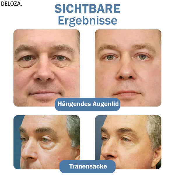 EyeRenew™ | Strahlende & jugendlich frische Augen-Erneuerung