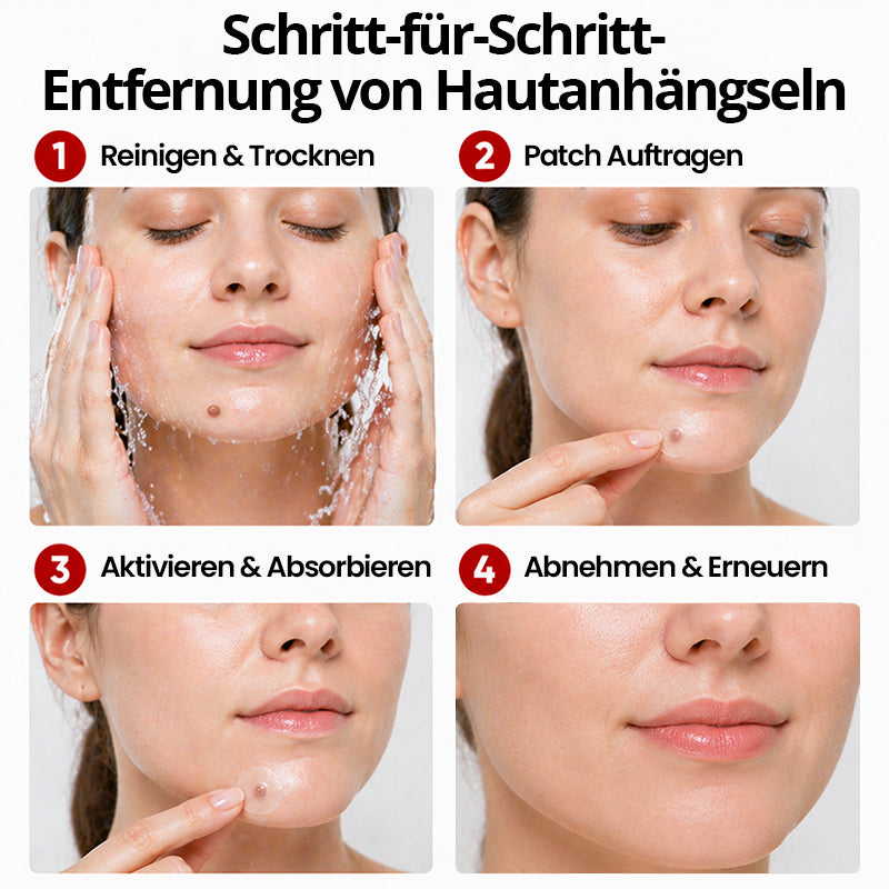 Hautpflaster zur Skin-Tag-Entfernung