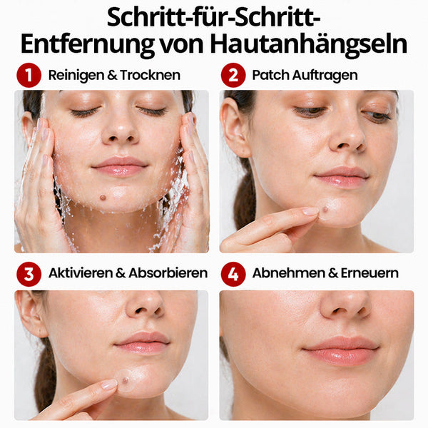 Hautpflaster zur Skin-Tag-Entfernung