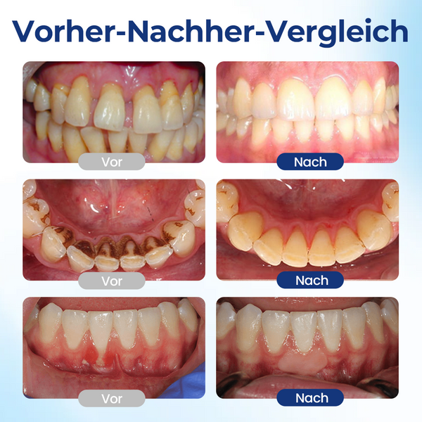 1+1 GRATIS | BeeTakt Zahnfleisch-Repair Lösung