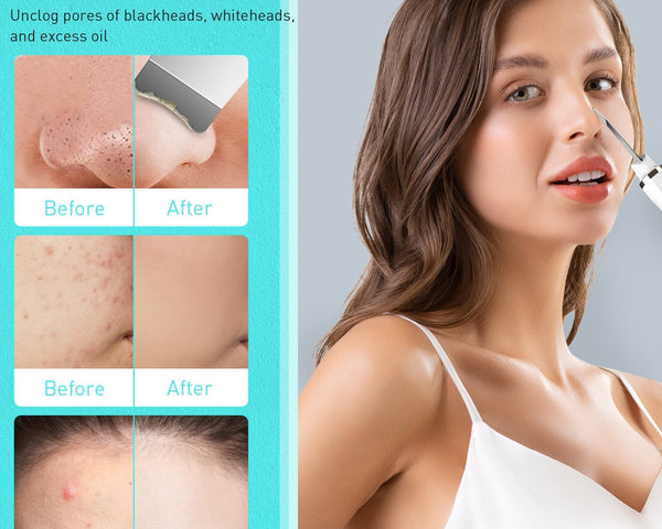 SkinRelief™ - Effektive Hautstraffung