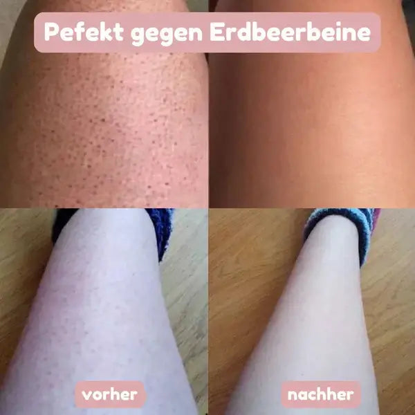 SeidenGlanz™ | 2 in 1 Damenrasierer für glatte und gepflegte Haut