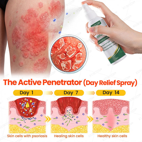 Psoriasis Tag- & Nacht-Reparatursystem | 24h Hautpflege-Duo