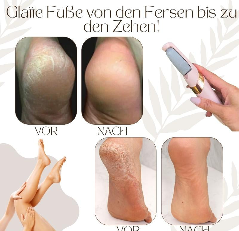 SilkStep™ | Elektrischer Hornhautentferner für glatte & gepflegte Füße