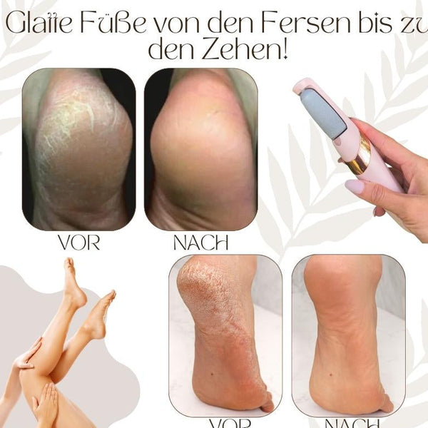 SilkStep™ | Elektrischer Hornhautentferner für glatte & gepflegte Füße