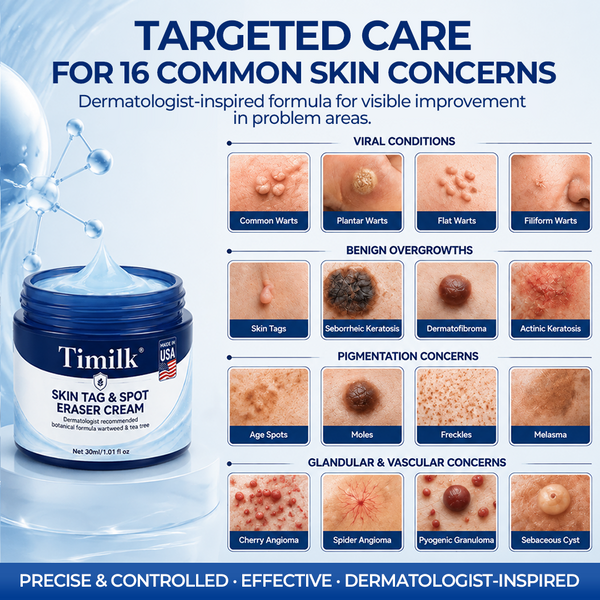 DermaVex™ 7-Tage Entferner Creme – Für Hautanhängsel & sichtbare Hautunreinheiten