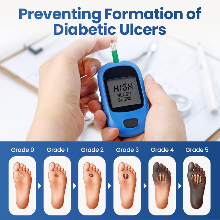 DermaShield™ Barrierespray für Diabetische Fußpflege