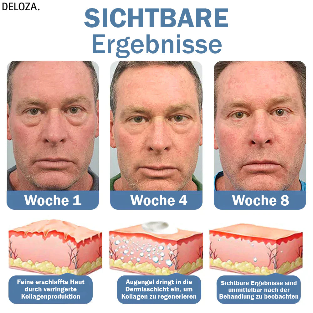 EyeRenew™ | Strahlende & jugendlich frische Augen-Erneuerung