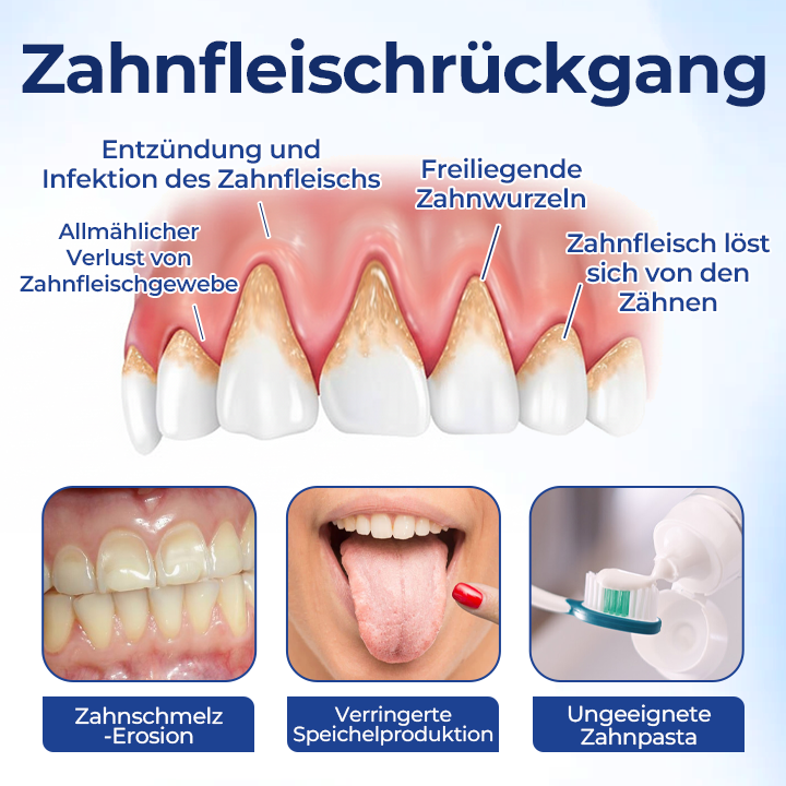 1+1 GRATIS | BeeTakt Zahnfleisch-Repair Lösung