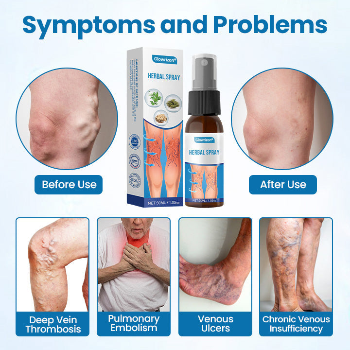 VeinFlow™ — Kräuter-Beinspray – Für Frische, Gepflegte & Angenehm Leichte Beine