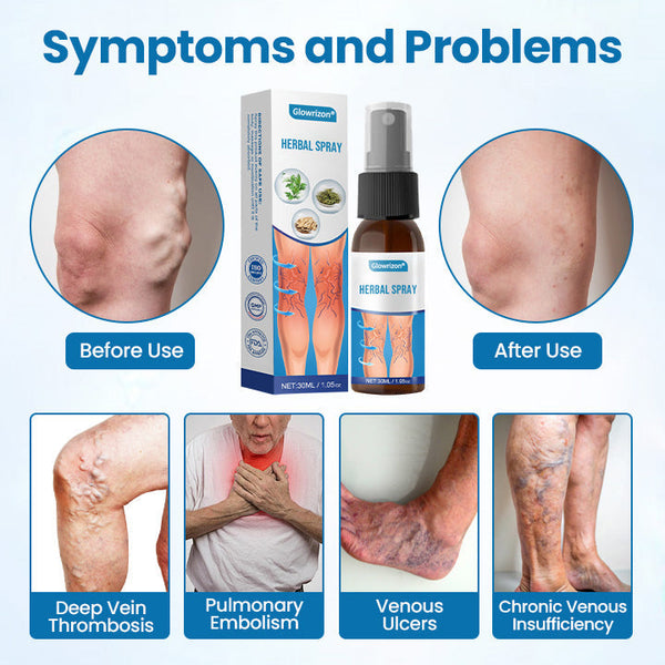 VeinFlow™ — Kräuter-Beinspray – Für Frische, Gepflegte & Angenehm Leichte Beine