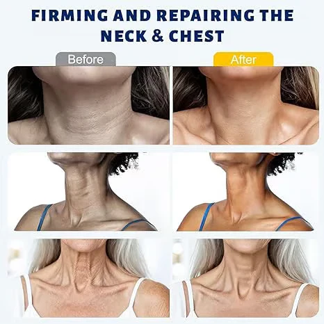 🔥 50% RABATT | SkinLift™ Straffende Kollagencreme mit 5-Rollen-Massagekopf