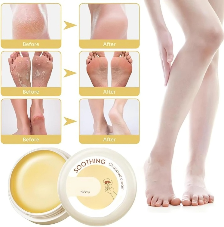 1+2 GRATIS | HydraHeel™ | Pflegende Creme für die tägliche Linderung.