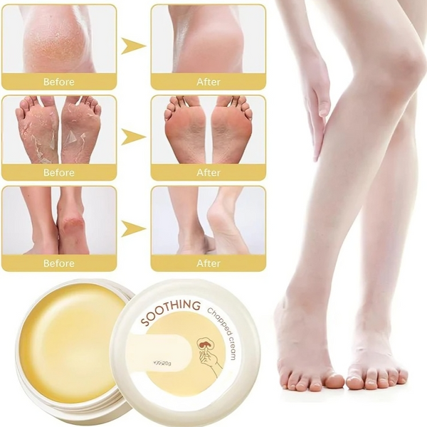 1+2 GRATIS | HydraHeel™ | Pflegende Creme für die tägliche Linderung.