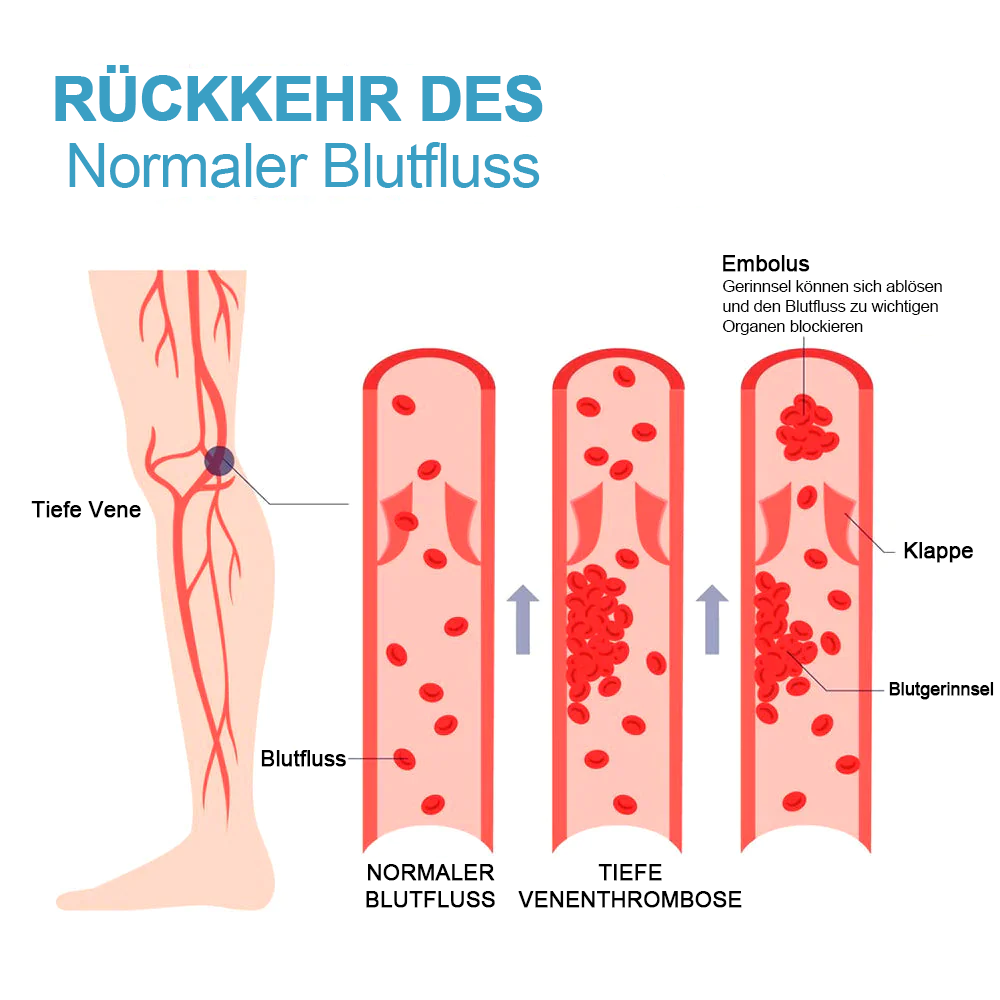 FormSocken™ - Schlanke Beine und straffe Haut in einem Schritt!