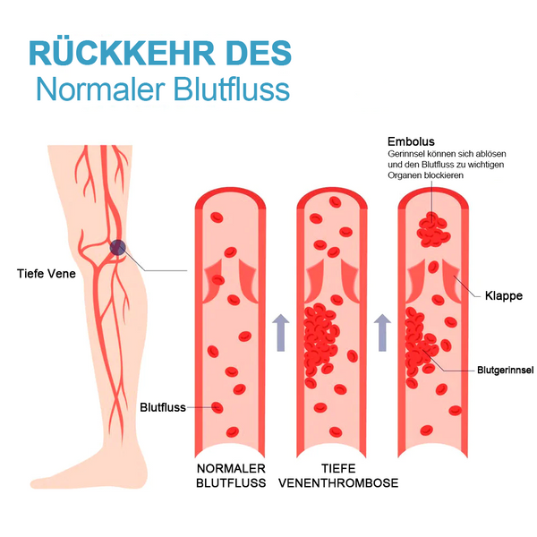 FormSocken™ - Schlanke Beine und straffe Haut in einem Schritt!