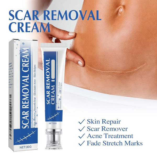 🔥 Letzter Tag: 50 % RABATT – 🩹 Alcuras® Medizinische Silikon-Narbencreme – Sichtbar glattere Haut ab der ersten Anwendung!