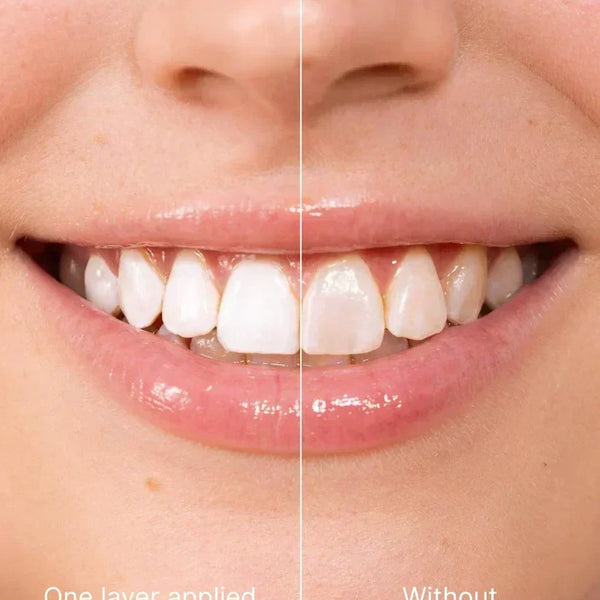 SmileLuxe™ Zahn-Polish – Sofort Strahlenderes Lächeln in Sekunden