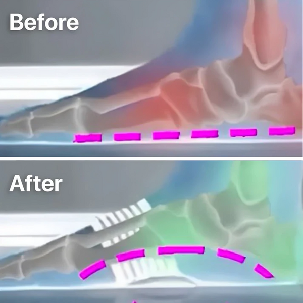1+1 Gratis | SohlenEntlastung™ Sofortige Linderung von Fußschmerzen
