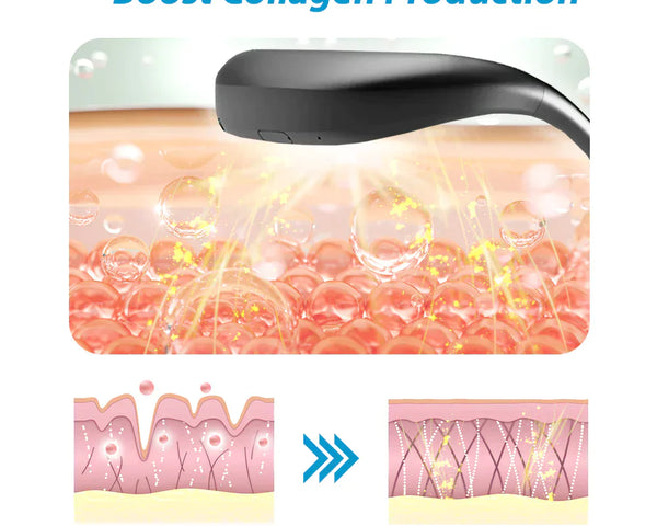 FaceRelief™ – Straffere, jugendlichere Haut in nur wenigen Anwendungen