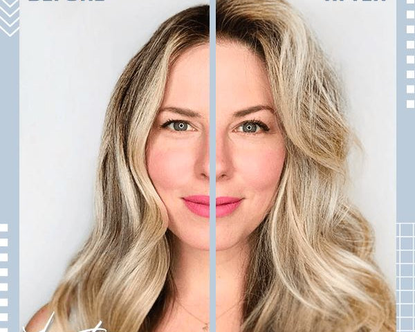 HaarLifting™ Clip zur Stärkung der Haarwurzeln