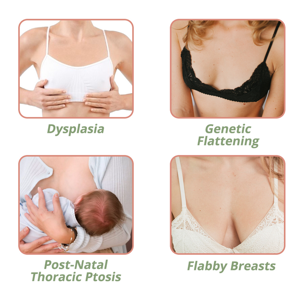 CurveAmore™ Brustvergrößerungsserum-Pflaster (1 + 1 GRATIS)