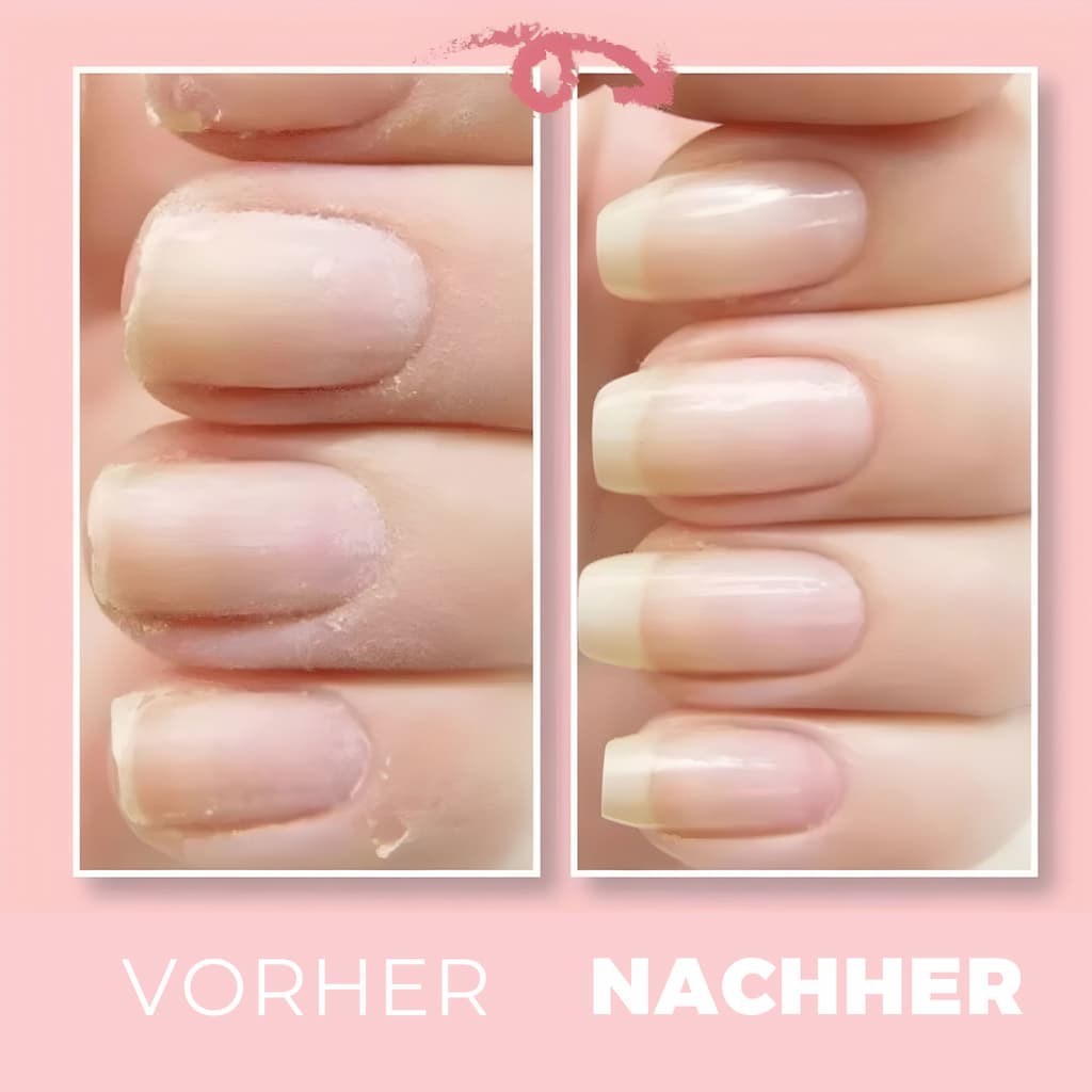 BibbidiNails™ Reparaturgel für Gesunde Nägel (1+1 GRATIS)