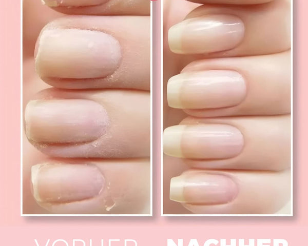 BibbidiNails™ Reparaturgel für Gesunde Nägel (1+1 GRATIS)