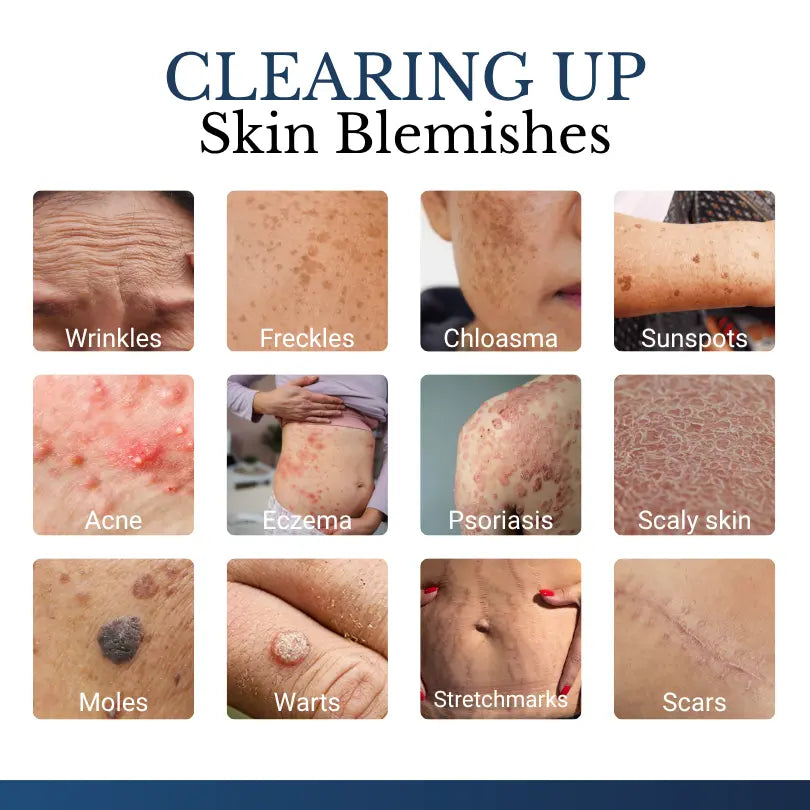 DermaVelle™ 2-in-1 Mikronadel-Pflaster – Für sichtbar glattere Haut & weniger Hautanhängsel