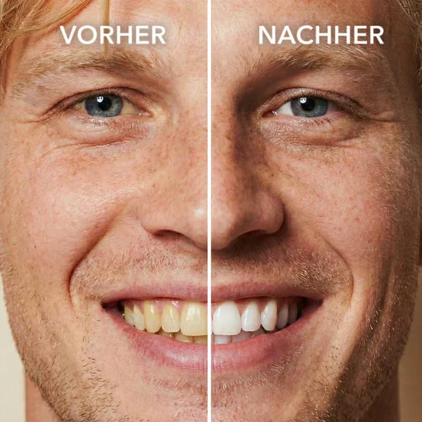 SmileLuxe™ Zahn-Polish – Sofort Strahlenderes Lächeln in Sekunden