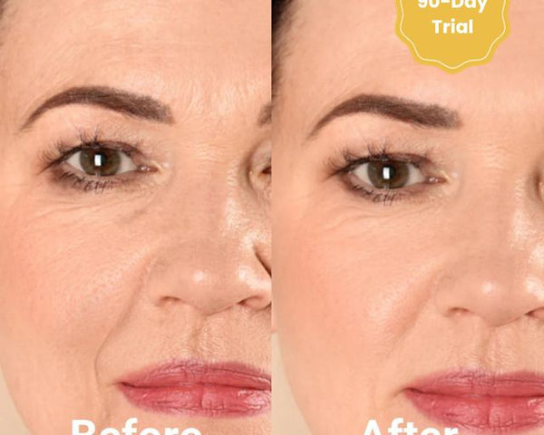 DermaFaden™ Vollständiges Kollagen-Fadenlifting-Kit