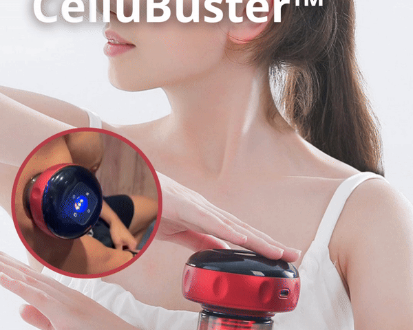 CelluliteBeruhigen™ Anti-Cellulite-Schröpfmassagegerät