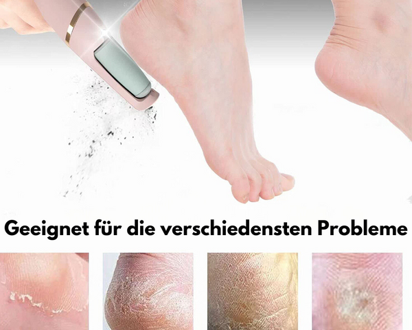 50% Rabatt | FeetCare™ - Hornhautentferner