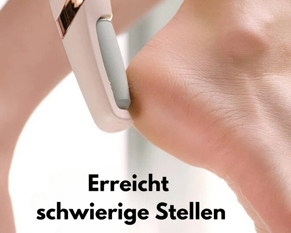 50% Rabatt | FeetCare™ - Hornhautentferner