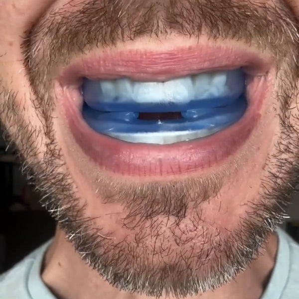 JawEase™ Anti-Snoring Mouthpiece – Für Ruhigere Nächte & Erholsameren Schlaf