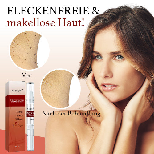 WipeClear™ Tags & Maulwurfsentferner (1+1 Gratis)