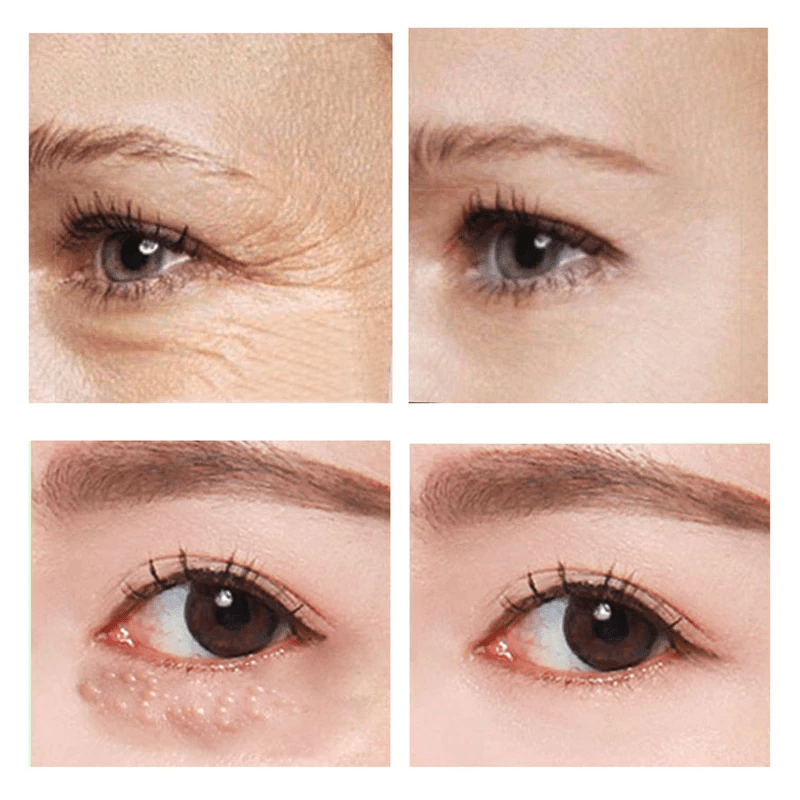 (1+1 GRATIS) InstantLift™ schnell wirkende Straffende Augencreme für die Unteraugenpartie