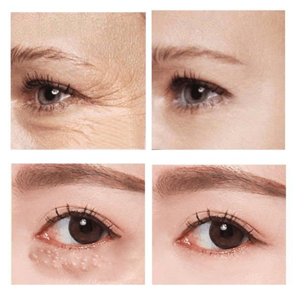 (1+1 GRATIS) InstantLift™ schnell wirkende Straffende Augencreme für die Unteraugenpartie