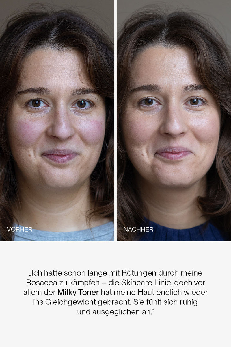 50% Rabatt | JACKS Milky Toner™ | Tiefe Feuchtigkeit, glattere Haut & weniger Rötungen – spürbar ab der ersten Anwendung!