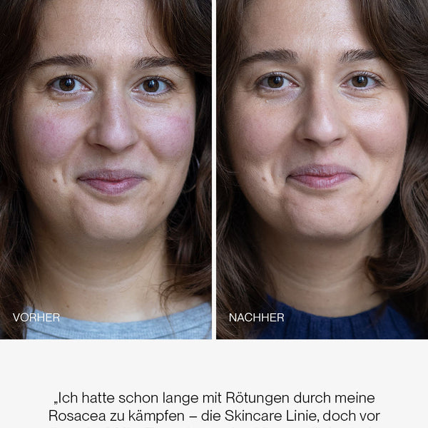 50% Rabatt | JACKS Milky Toner™ | Tiefe Feuchtigkeit, glattere Haut & weniger Rötungen – spürbar ab der ersten Anwendung!