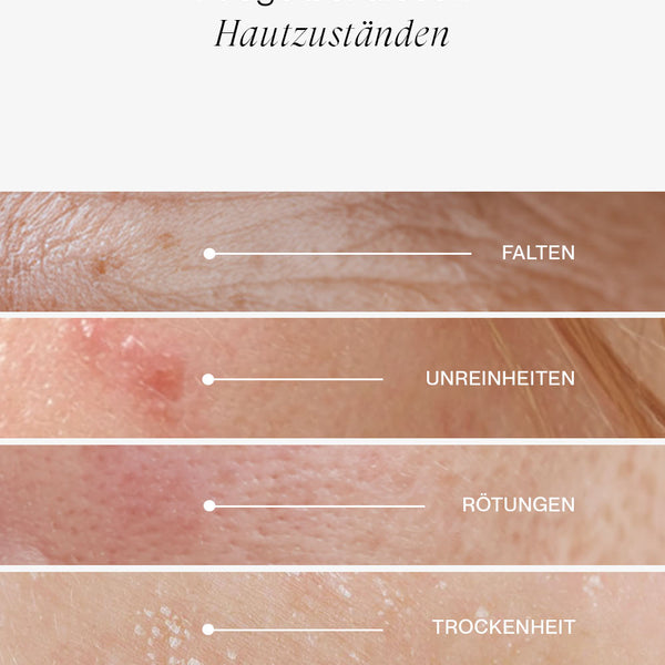 50% Rabatt | JACKS Milky Toner™ | Tiefe Feuchtigkeit, glattere Haut & weniger Rötungen – spürbar ab der ersten Anwendung!