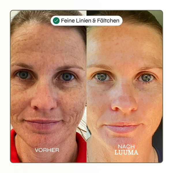 50% Rabatt | Kollagen Glow Maske™ | Straffere & frischere Haut schon nach der ersten Anwendung!