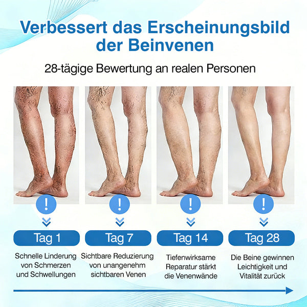 🇩🇪🏃‍🌿GFOUK® VascuCare Vein Healing Spray(Entwickelt für Krampfadern, Besenreiser, tiefe Venenthrombose (TVT), chronische venöse Insuffizienz, venöse Geschwüre, Thrombophlebitis und andere venöse Beschwerden)