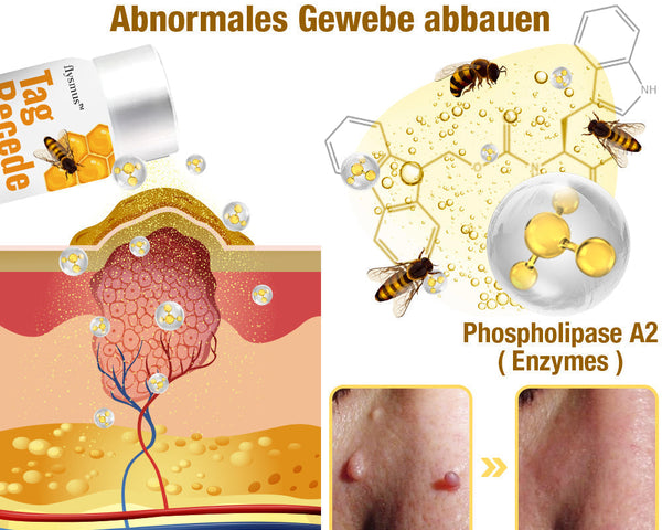 HonigHeilen™ Tag Recede Bienengift Behandlung Spray