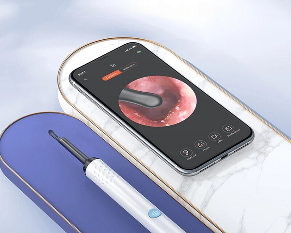HealthView™ – Präzises Endoskop zur sicheren Ohrenschmalz-Entfernung