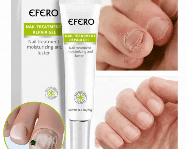 NagelRettung™ Wiederherstellende Nageltherapie