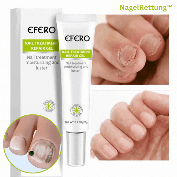 NagelRettung™ Wiederherstellende Nageltherapie